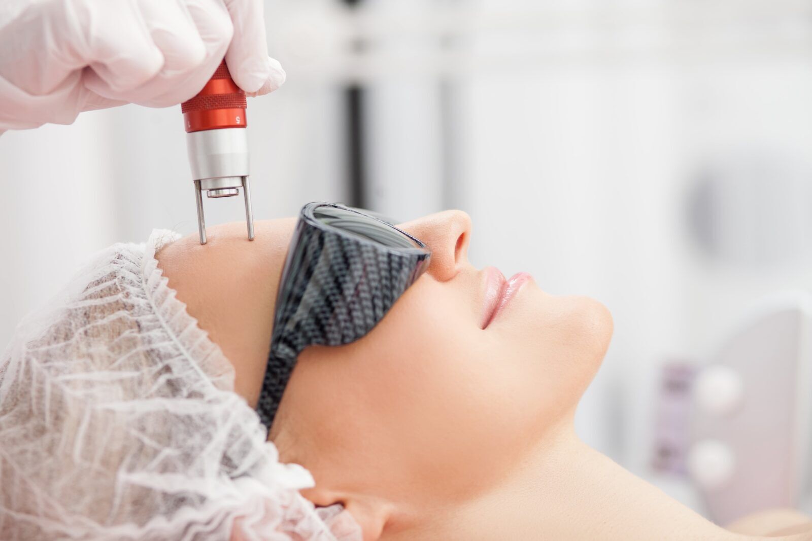 Understanding PicoSure Laser Treatment | Annapolis and Severna Park, MD